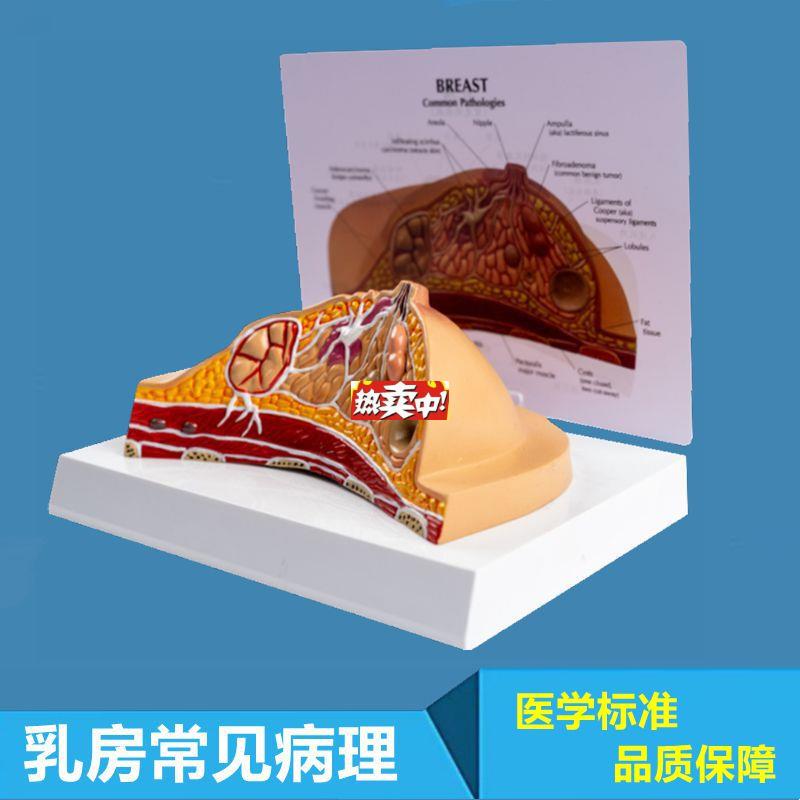热销病理乳房模型乳腺结构哺乳期静x止女性生殖月嫂培训产康家政