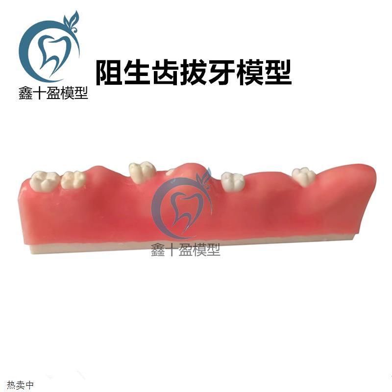 热销牙科阻生齿拔牙模型牙E齿模型口腔教学仿真口腔护理牙医诊所