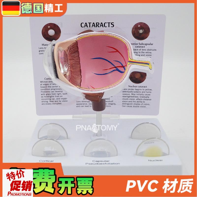 德国】眼球模型病理眼球演示教z具眼科展示礼品人体器官解剖模型