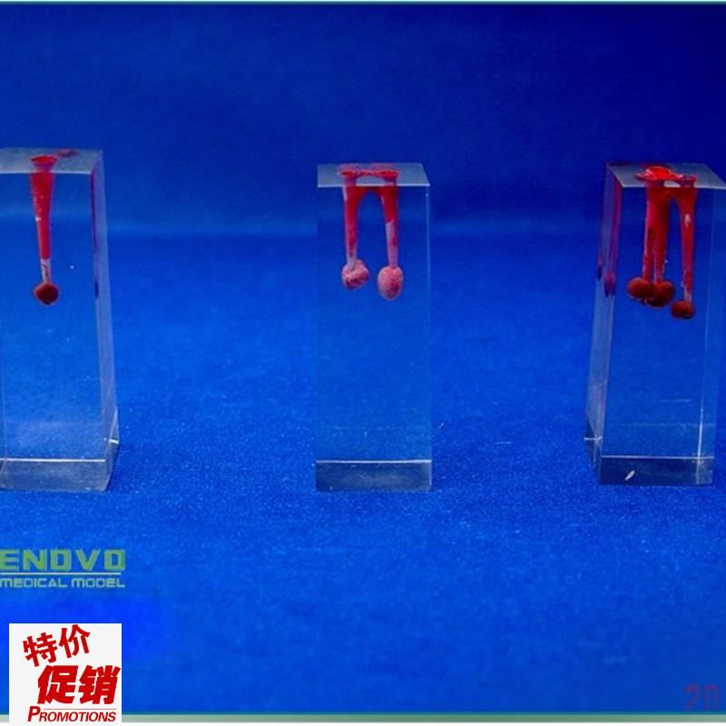 颐诺正品口腔科实习用根t管模型牙体牙髓学根管充填和窝洞制备