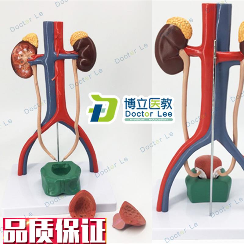 人体泌尿系统模型肾输尿管膀胱尿道解I剖模型医学泌尿科解剖模型