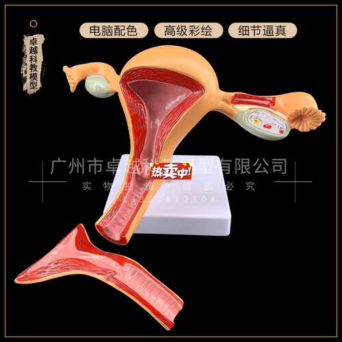 热销正常子宫模型h卵巢病理病变模型生殖科女性子宫阴道模型包