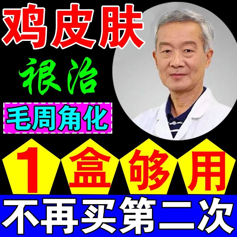 鸡皮肤有什么药膏可以去掉(去鸡皮肤最有效的药膏 强推四种)