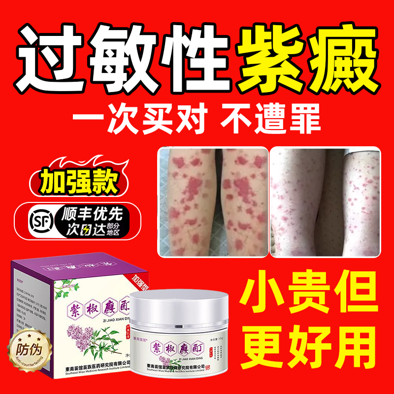 过敏性紫癜色素过敏性皮炎血管炎