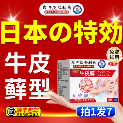 【日本技术】牛皮癣药膏进口治疗
