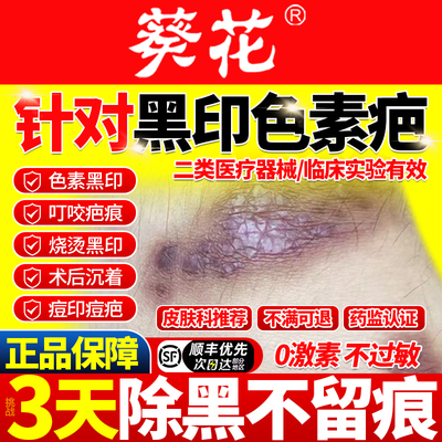 黑色素沉淀去除祛疤膏痕痘印去黑