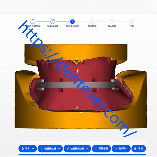 【蜡堤设计】牙科 CAD 软件