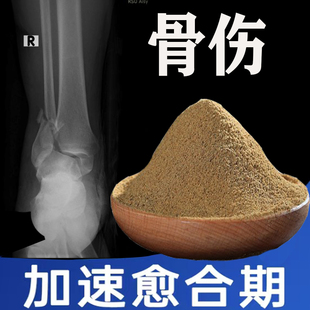 跌打损伤骨断裂折恢复专用膏崴脚关节肌肉拉伤脚踝扭伤外敷药膏