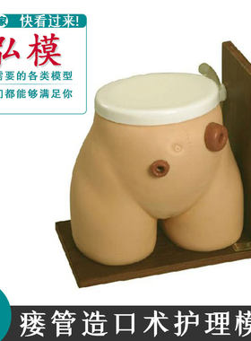 正品瘘管造口术护理模型回肠造痿