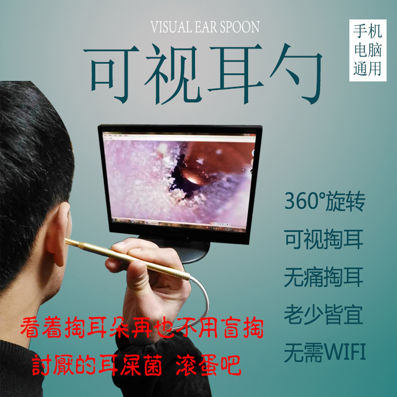 发光耳勺 可视耳勺 检耳镜 手耳勺