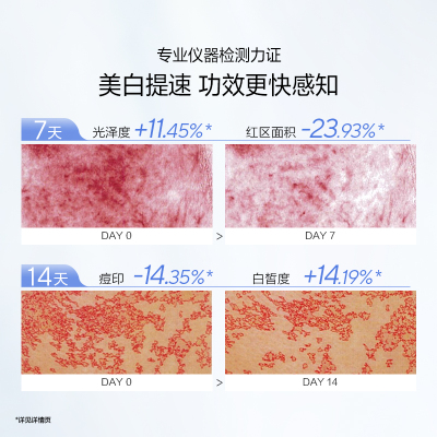 【蜂狂双11】欧诗漫珍白因水乳套装美白淡斑补水保湿