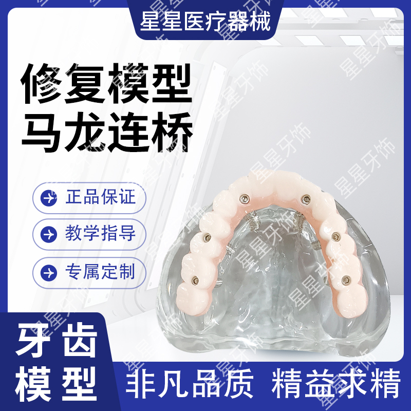 牙科口腔马龙桥义齿种植修复模型