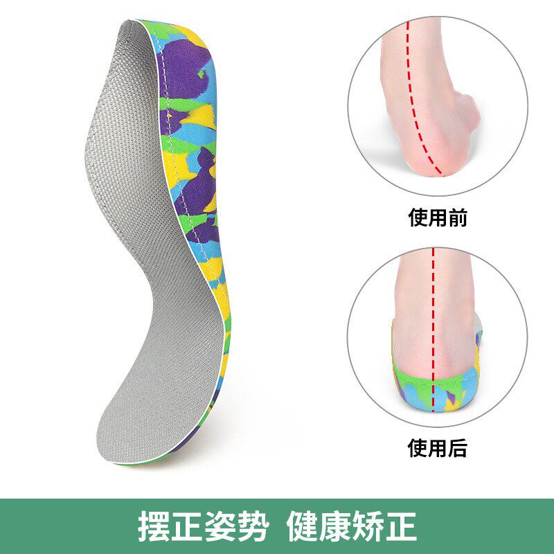 儿童成人足内外翻高弓足扁平足矫正足弓支撑鞋垫纠正XO型腿罗圈腿