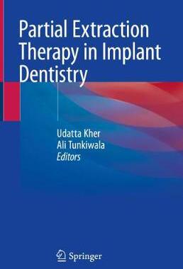 【预订】Partial Extraction Therapy in Implant Dentistry