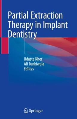 【预订】Partial Extraction Therapy in Implant Dentistry