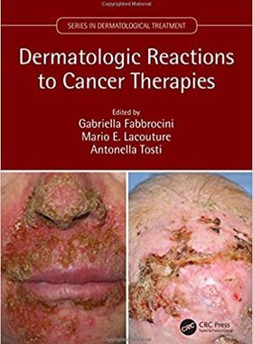【预订】Dermatologic Reactions to Cancer Therapies