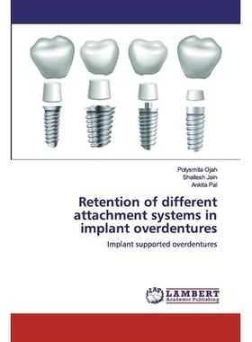 预订 Retention of different attachment systems in implant overdentures:Implant supported overdentures: Implant supported