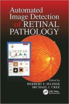 【预售】Automated Image Detection of Retinal Pathology