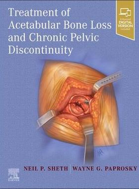 [预订]Treatment of Acetabular Bone Loss and Chronic Pelvic Discontinuity 9780323875509