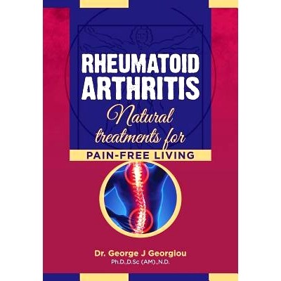 预订 Rheumatoid Arthritis: Natural Treatments for Pain-Free Living: 9789925569366