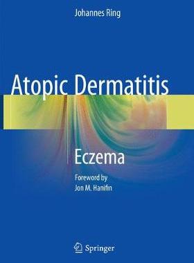 预订 Atopic Dermatitis