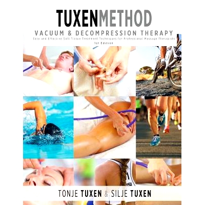 预订 TuxenMethod Vacuum & Decompression Therapy: Easy and Effective Soft Tissue Treatment Techniques for Professional Ma