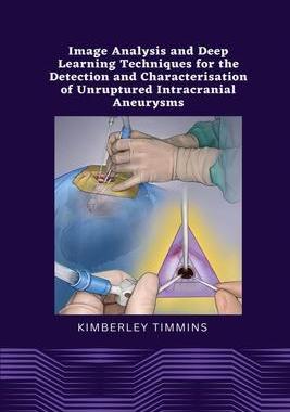 [预订]Image Analysis and Deep Learning Techniques for the Detection and Characterisation of Unruptured Int 9782199825817