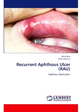 预订 Recurrent Aphthous Ulcer (RAU) 复发性口疮(RAU): 9786207461332