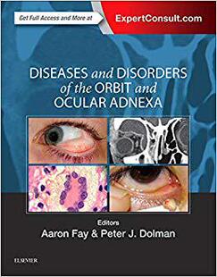 Ocular Adnexa Disorders Orbit and Diseases 预售 the