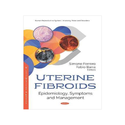 [预订]Uterine Fibroids: Epidemiology, Symptoms and Management 9781536150469
