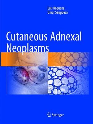 【预订】Cutaneous Adnexal Neoplasms