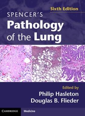 【预订】Spencer’s Pathology of the Lung 2 Part Set with DVDs