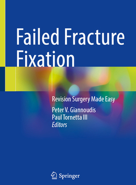 预订 Failed Fracture Fixation