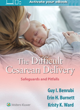 【预订】The Difficult Cesarean Delivery: Safeguards and Pitfalls