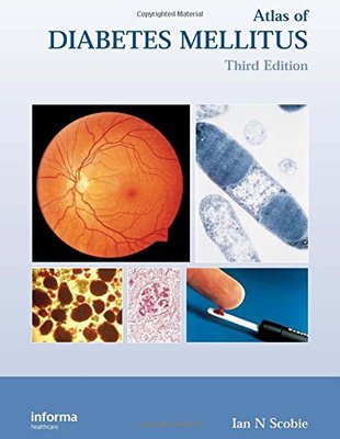 【预订】Atlas of Diabetes Mellitus, Third Edition