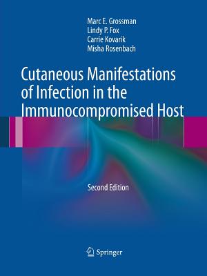 【预订】Cutaneous Manifestations of Infection in the Immunocompromised Host