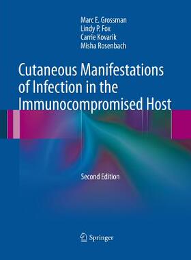 【预订】Cutaneous Manifestations of Infection in the Immunocompromised Host