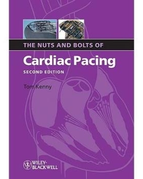预订 The Nuts And Bolts Of Cardiac Pacing 2E 心脏起搏要点: 9781405184038