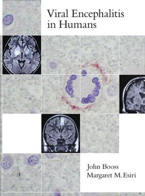 【预订】Viral Encephalitis in Humans