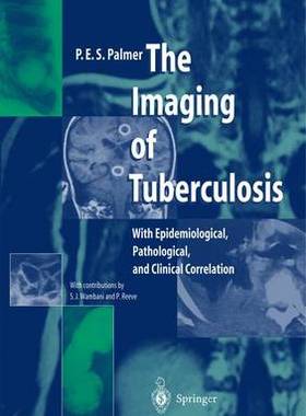 预订 The Imaging of Tuberculosis