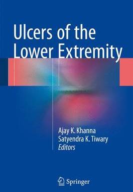 预订 Ulcers of the Lower Extremity