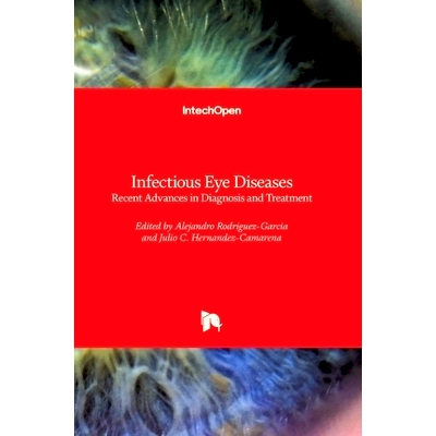 预订 Infectious Eye Diseases - Recent Advances in Diagnosis and Treatment 传染性眼病 - 诊断和治疗的*进展: 9781839693199
