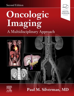 【预订】Oncologic Imaging: A Multidisciplinary Approach 9780323695381