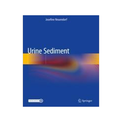 [预订]Urine Sediment 9783030159139