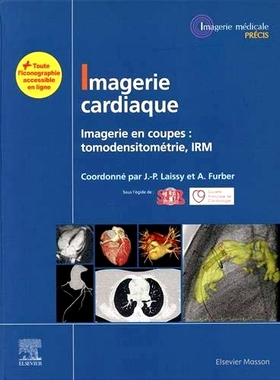 预订 Imagerie cardiaque : imagerie en coupes : tomodensitométrie, IRM 心脏成像：横断面成像：CT、MRI: 9782294767234