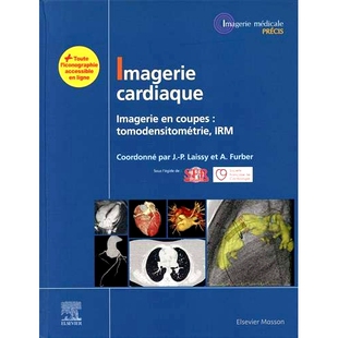 预订 Imagerie cardiaque : imagerie en coupes : tomodensitométrie, IRM 心脏成像：横断面成像：CT、MRI: 9782294767234
