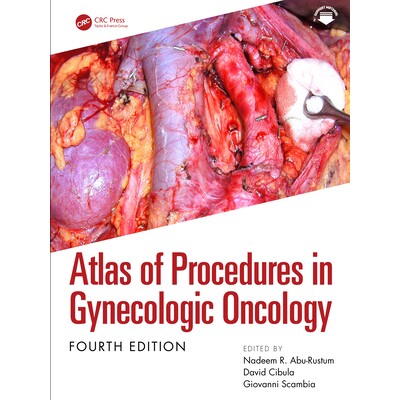 预订 Atlas of Procedures in Gynecologic Oncology 妇科肿瘤学手术图谱 第4版 9781032616636