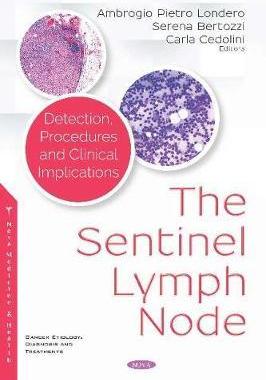 [预订]The Sentinel Lymph Node: Detection, Procedures and Clinical Implications 9781536145571