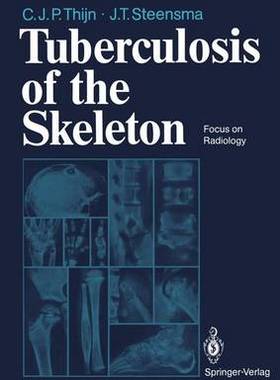 预订 Tuberculosis of the Skeleton