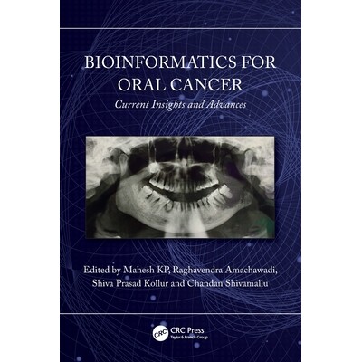 预订 Bioinformatics for Oral Cancer Current Insights and Advances 口腔癌生物信息学:当前见解与进展 9781032625669
